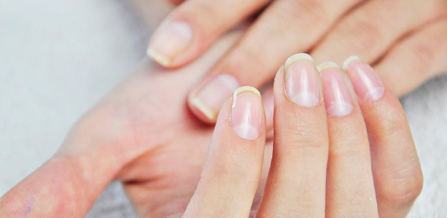 Was ist Wimpernlifting und für wen ist es geeignet?