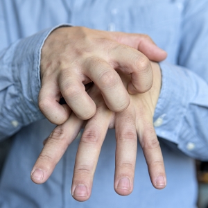 Man scratching his hand